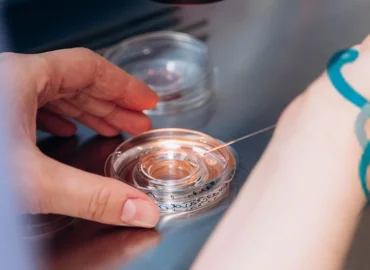 Ankara Tüp Bebek Uzmanları Hakkında Bilmeniz Gerekenler